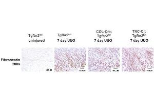 Fibronectin staining using ABIN5596760 were performed on 7 day UUO kidneys. (Fibronectin antibody)