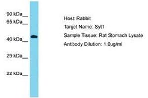 Image no. 1 for anti-Synaptotagmin I (SYT1) (AA 104-153) antibody (ABIN6750420) (SYT1 antibody  (AA 104-153))