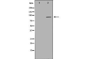 Western blot analysis of Hela whole cell lysates, using UHRF1  Antibody. (UHRF1 antibody  (N-Term))