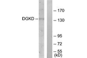 Western blot analysis of extracts from HuvEc cells, using DGKD Antibody. (DGKD antibody  (AA 41-90))
