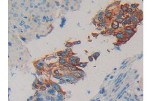 Detection of CK 20 in Human Lung Tissue using Polyclonal Antibody to Cytokeratin 20 (CK 20) (KRT20 antibody  (AA 9-424))