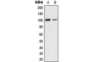 Western blot analysis of GLUR2 expression in human brain (A), mouse cortex (B) whole cell lysates. (GRIA2 antibody  (C-Term))