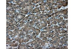 Immunohistochemical staining of paraffin-embedded Kidney tissue using anti-ACSBG1 mouse monoclonal antibody. (ACSBG1 antibody)