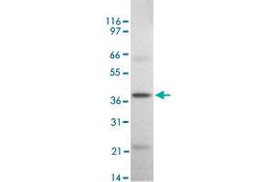 Western blot analysis of DAPK2 in rat kidney tissue lysate using DAPK2 polyclonal antibody  at 2 ug/mL . (DAPK2 antibody  (AA 325-342))