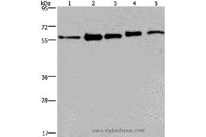 Western blot analysis of MCF-7, 293T, A549, Hela and HepG2 cell, using HNRNPL Polyclonal Antibody at dilution of 1:450 (HNRNPL antibody)