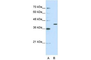 WB Suggested Anti-THEX1 Antibody Titration:  2.