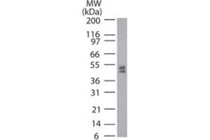 Western blot analysis of Trdmt1 in mouse ES cell lysate using Trdmt1 polyclonal antibody  at 2 ug/mL . (Dnmt2 antibody  (AA 39-53))