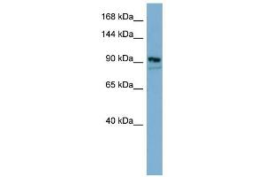 FAM62B antibody used at 1 ug/ml to detect target protein. (FAM62B antibody)