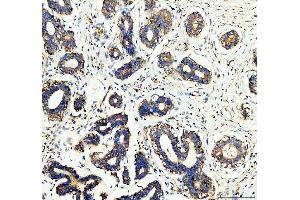 IHC analysis of WDR1 using anti-WDR1 antibody (ABIN4886763).
