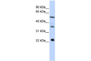WB Suggested Anti-CENPM Antibody Titration:  0. (CENPM antibody  (Middle Region))