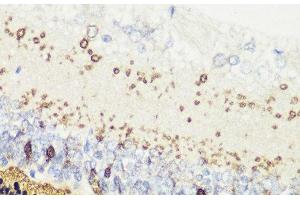 Immunohistochemistry of paraffin-embedded Rat retina using RCVRN Polyclonal Antibody at dilution of 1:200 (40x lens). (Recoverin antibody)