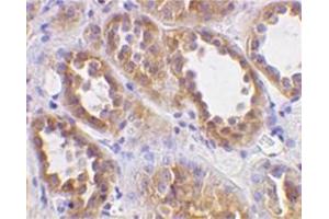 Image no. 1 for anti-Angiotensin I Converting Enzyme 2 (ACE2) (N-Term) antibody (ABIN319091) (ACE2 antibody  (N-Term))