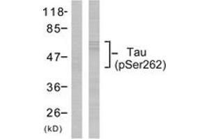 Western Blotting (WB) image for anti-Microtubule-Associated Protein tau (MAPT) (pSer262) antibody (ABIN2888545)