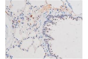 ABIN6267508 at 1/200 staining Rat lung tissue sections by IHC-P. (STAT1 antibody  (pSer727))