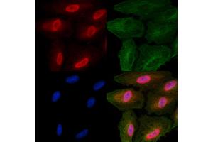 ABIN6265373 and ABIN6266661 staining  cells by IF/ICC.