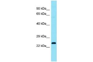 Host: Rabbit Target Name: C4orf45 Sample Type: Fetal Lung lysates Antibody Dilution: 1. (C4ORF45 antibody  (C-Term))
