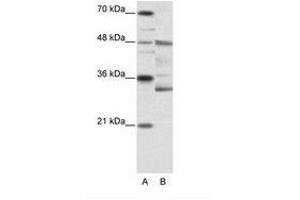 Image no. 1 for anti-Forkhead Box N2 (FOXN2) (N-Term) antibody (ABIN6736146) (FOXN2 antibody  (N-Term))