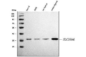 anti-Solute Carrier Family 35, Member A4 (SLC35A4) (AA 1-142) antibody