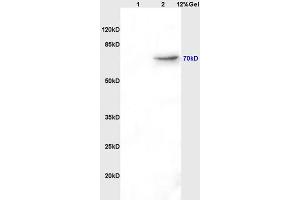 Lane 1: rat brain lysates Lane 2: rat kidney lysates probed with Mouse Anti-AFP(A2) Monoclonal Antibody, Unconjugated (ABIN722901) at 1:200 in 4 °C. (alpha Fetoprotein antibody)