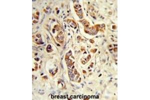 Immunohistochemistry (IHC) image for anti-Neutrophil Cytosolic Factor 1C Pseudogene (NCF1C) antibody (ABIN3003869) (NCF1C antibody)