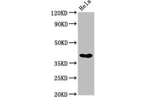 Western Blot Positive WB detected in: Hela whole cell lysate All lanes: NKX2-3 antibody at 3. (NK2 Homeobox 3 antibody  (AA 52-148))