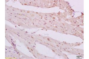 Formalin-fixed and paraffin embedded rat heart tissue labeled with Anti-Phospho-VASP(Ser239) Polyclonal Antibody, Unconjugated (ABIN746753) at 1:200 followed by conjugation to the secondary antibody and DAB staining (VASP antibody  (pSer239))