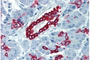 Pancreas, Human: Formalin-Fixed, Paraffin-Embedded (FFPE) (Cytokeratin 19 antibody  (C-Term))