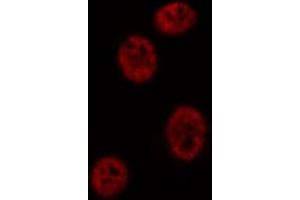 ABIN6269286 staining Hep G2 cells by IF/ICC. (Ataxin 1 antibody  (C-Term))