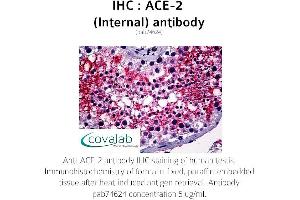 Image no. 1 for anti-Angiotensin I Converting Enzyme 2 (ACE2) (Internal Region) antibody (ABIN5693460) (ACE2 antibody  (Internal Region))