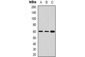 Western blot analysis of Cytochrome P450 24A1 expression in Jurkat (A), A431 (B), HepG2 (C) whole cell lysates. (CYP24A1 antibody  (C-Term))