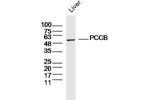 Mouse liver lysates probed with PCCB Polyclonal Antibody, Unconjugated  at 1:300 dilution and 4˚C overnight incubation. (PCCB antibody  (AA 321-420))