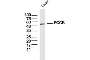 Mouse liver lysates probed with PCCB Polyclonal Antibody, Unconjugated  at 1:300 dilution and 4˚C overnight incubation.