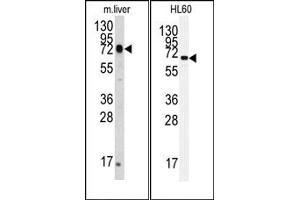 Image no. 1 for anti-Heat Shock 70kDa Protein 5 (Glucose-Regulated Protein, 78kDa) (HSPA5) antibody (ABIN356850)