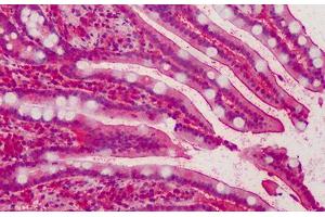 Human Small Intestine: Formalin-Fixed, Paraffin-Embedded (FFPE) (MPP5 antibody  (AA 174-187))