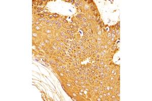(ABIN6242763 and ABIN6577904) staining SNCA in Human skin tissue sections by Immunohistochemistry (IHC-P - paraformaldehyde-fixed, paraffin-embedded sections). (SNCA antibody  (C-Term))