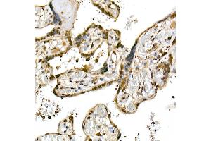 Immunohistochemistry of paraffin-embedded human placenta using Ube2L3 / UBCH7 Rabbit mAb (ABIN7271178) at dilution of 1:25 (40x lens). (UBE2L3 antibody)