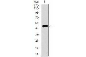Western Blotting (WB) image for anti-RAB4A, Member RAS Oncogene Family (RAB4A) antibody (ABIN1108812) (Rab4 antibody)