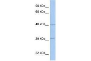Image no. 1 for anti-ADP-Ribosyltransferase 5 (ART5) (AA 215-264) antibody (ABIN6743506) (ART5 antibody  (AA 215-264))
