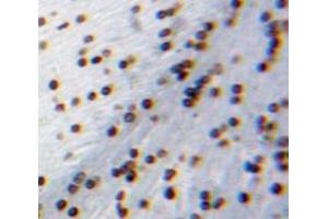 Used in DAB staining on fromalin fixed paraffin-embedded Brain tissue (CIDEA antibody  (AA 1-219))