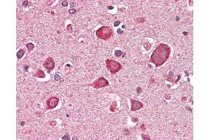 Anti-GABRA6 antibody IHC staining of human brain, cortex. (GABRA6 antibody  (AA 15-26))