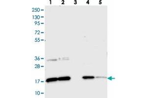 Western blot analysis of Lane 1: RT-4, Lane 2: U-251 MG, Lane 3: Human Plasma, Lane 4: Liver, Lane 5: Tonsil with CNPY2 polyclonal antibody . (CNPY2/MSAP antibody)