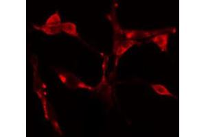 ABIN6274617 staining Hela cells by IF/ICC. (CDCA7 antibody  (Internal Region))