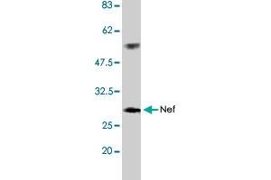 Detection of HIV-1 Nef by Western blotting using the HIV-1 Nef polyclonal antibody  . (HIV-1 Nef antibody)