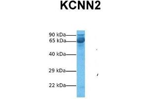 Host:  Rabbit  Target Name:  KCNN2  Sample Tissue:  Human Fetal Liver  Antibody Dilution:  1. (KCNN2 antibody  (C-Term))