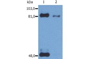 Western Blotting analysis (reducing conditions) of phosphorylated STAT1 (Ser727) in IFN-γ treated HeLa human cervix carcinoma cell line using anti-Phospho STAT1 (PSM1). (STAT1 antibody  (pSer727))