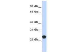 Image no. 1 for anti-FK506 Binding Protein 11, 19 KDa (FKBP11) (AA 35-84) antibody (ABIN6740999) (FKBP11 antibody  (AA 35-84))