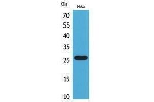 Western Blotting (WB) image for anti-CD302 (CD302) (Internal Region) antibody (ABIN3181042) (DCL1 antibody  (Internal Region))