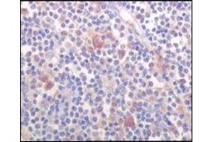 Immunohistochemistry (IHC) image for anti-Bruton Agammaglobulinemia tyrosine Kinase (BTK) (truncated) antibody (ABIN2464023) (BTK antibody  (truncated))