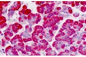 Human Pancreas: Formalin-Fixed, Paraffin-Embedded (FFPE) (FKBP11 antibody  (AA 52-82))