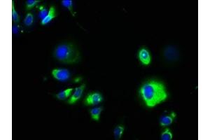 Immunofluorescence staining of MCF-7 cells with ABIN7147319 at 1:133, counter-stained with DAPI. (GPA33 antibody  (AA 22-235))